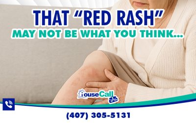 From Red Rash to Venous Ulcer by Dr. Kacian Brown: What Stasis Dermatitis Really Means