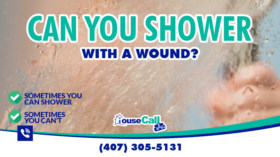 Can You Take a Shower With a Wound? Here’s What You Need to Know